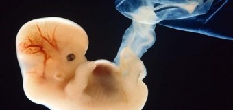 Европейский суд: Италия не нарушает прав человека, отказав в использовании неимплантированных эмбрионов