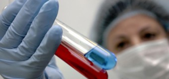 Эксперт: Эпидемия ВИЧ в некоторых регионах РФ достигла высшей стадии
