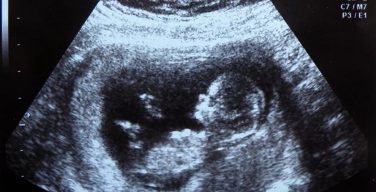РПЦ предложила законодательно запретить врачам предлагать беременным аборты